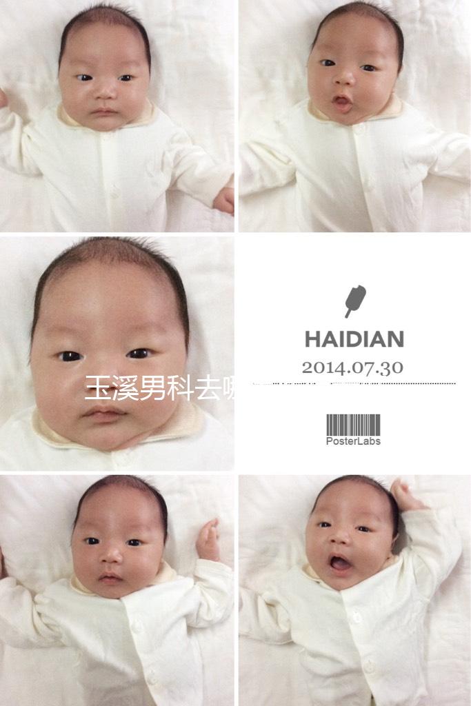 玉溪男科去哪家醫(yī)院看好，怎么選攻略，這個(gè)排行榜不要錯(cuò)過(guò)