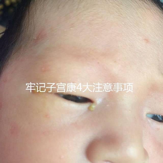 牢記子宮康4大注意事項(xiàng),輕松避免胃脹、腹瀉等副作用