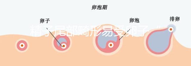 精子尾部畸形易受卵子“嫌棄”，無尾、短卷尾需重視