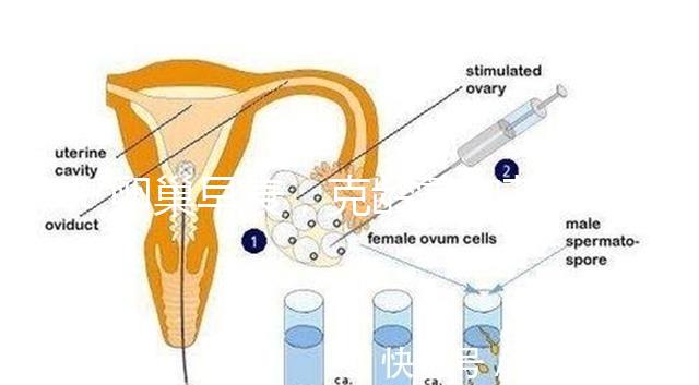 卵巢早衰，克齡蒙和芬嗎通藥物選擇引爭議