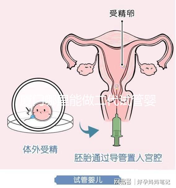 廈門哪里能做二代試管嬰兒，做一次成功率和費用多少？