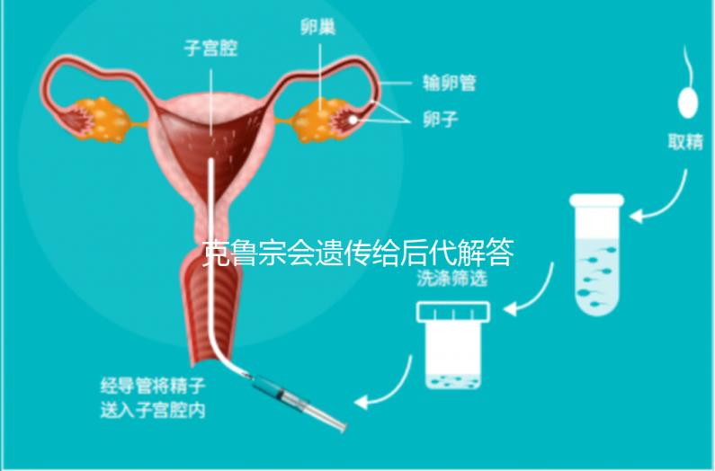 克魯宗會遺傳給后代解答嗎？他生來就有一篇清晰的文章嗎？