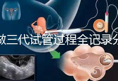 做三代試管過程全記錄分享（北醫(yī)三院）