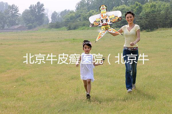 北京牛皮癬醫(yī)院(北京牛皮癬醫(yī)院排名)