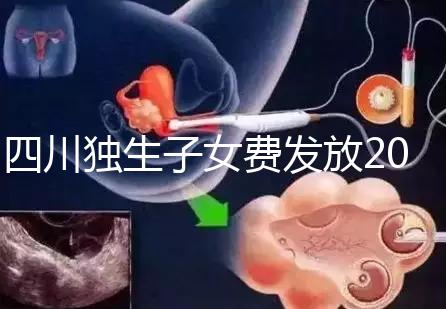 四川獨(dú)生子女費(fèi)發(fā)放2024年新規(guī)定，如何盡快領(lǐng)取自貢？