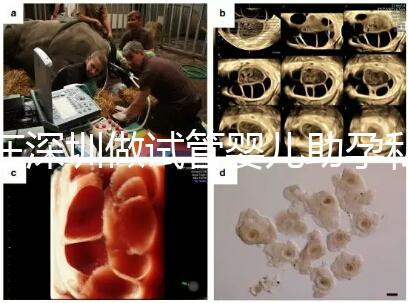 在深圳做試管嬰兒助孕私人機(jī)構(gòu)收費(fèi)標(biāo)準(zhǔn)是怎樣的