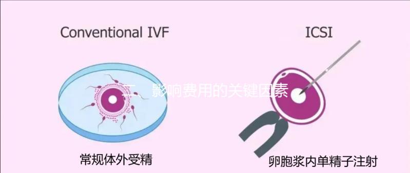 二、影響費用的關鍵因素