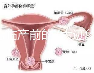 二胎臨產前的7大跡象，出現見紅、陣痛別大意