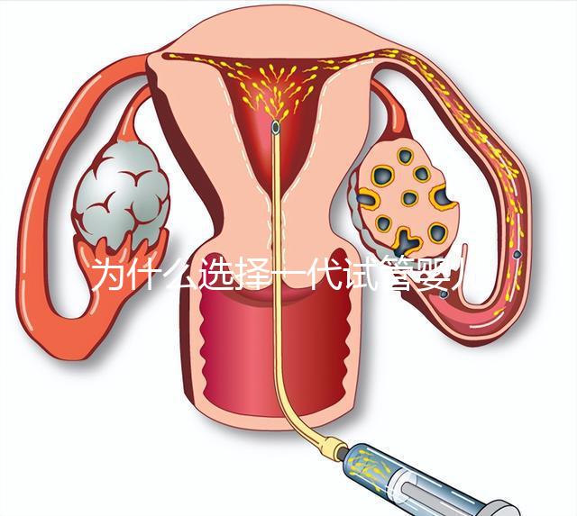 為什么選擇一代試管嬰兒?全面解析其獨特優(yōu)勢與適用場景