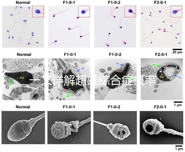 一文詳解超雄綜合癥概率有多大，想造的人多不多看過來