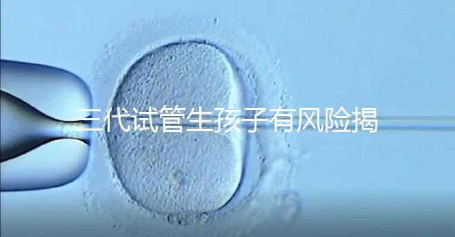 三代試管生孩子有風(fēng)險揭秘嗎？嬰兒會有問題嗎？