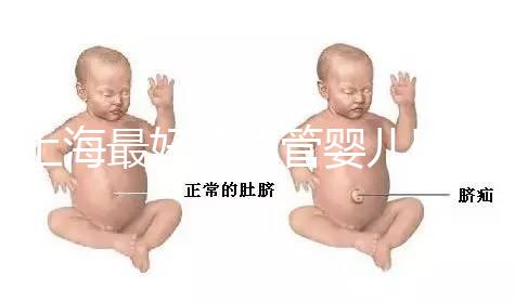 上海最好的試管嬰兒醫院信息匯總，想要最權威真得看這幾家