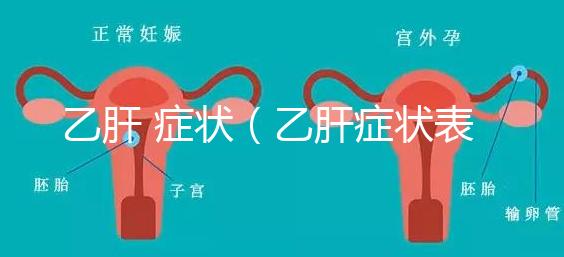 乙肝 癥狀（乙肝癥狀表現有哪些）