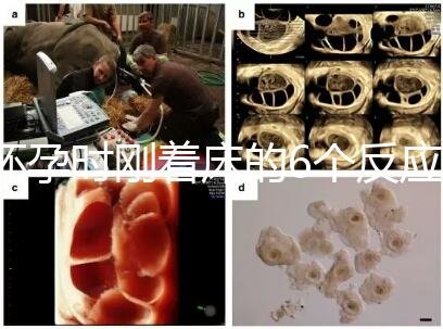 懷孕時剛著床的6個反應(yīng)，同房后這個時候觀察身體最準(zhǔn)