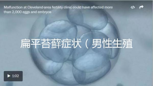 扁平苔蘚癥狀(男性生殖扁平苔蘚癥狀)