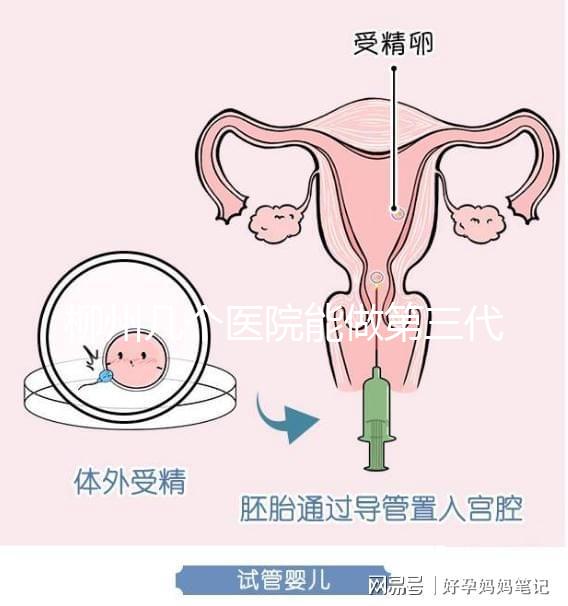 柳州幾個醫院能做第三代試管嬰兒?詳細的費用成功率都在這
