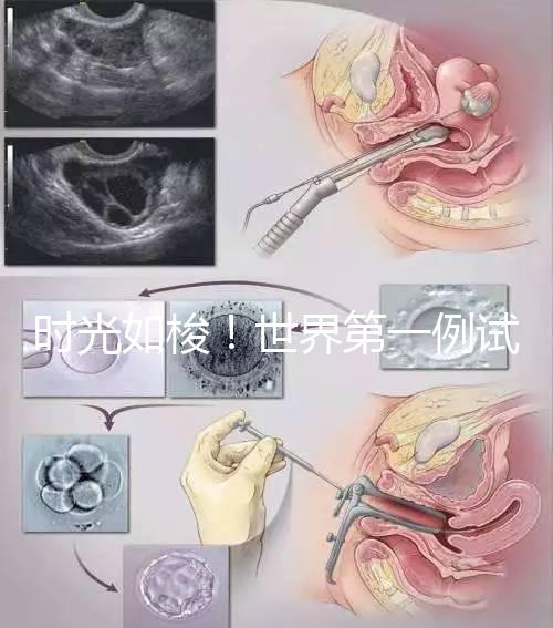 時光如梭！世界第一例試管嬰兒路易絲·布朗已經41歲啦