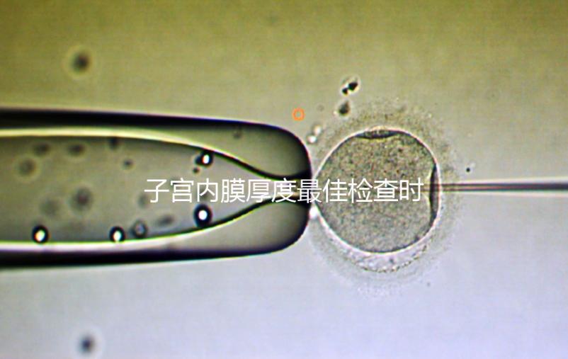 子宮內(nèi)膜厚度最佳檢查時(shí)期，你有必要提前知道！