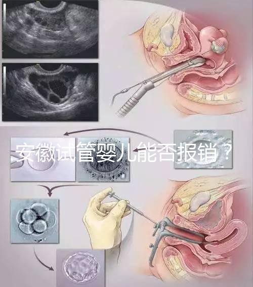 安徽試管嬰兒能否報(bào)銷？政策解讀幫您省錢！