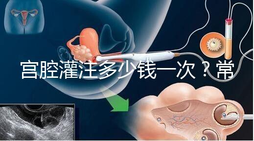 宮腔灌注多少錢一次？常見疑問匯總答疑