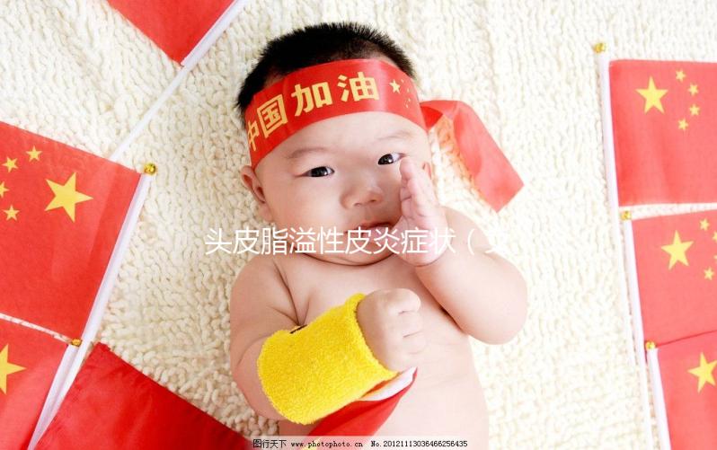 頭皮脂溢性皮炎癥狀（女性脂溢性脫發(fā)怎么治療最有效）