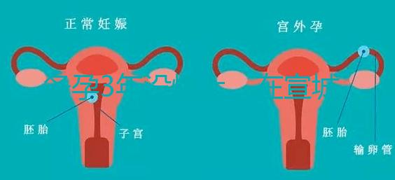 備孕3年沒懷上，在宣城可以做試管嬰兒嗎？