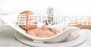 如何查看唐氏篩查結果，珠海醫院價格二百四起