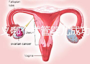 遵義哪個試管嬰兒成功率高？貴州生殖中心醫院2024年排名參考