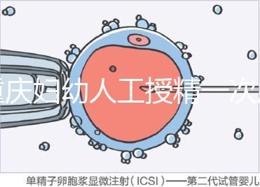 重慶婦幼人工授精一次成功率揭秘，移植費用貴有原因