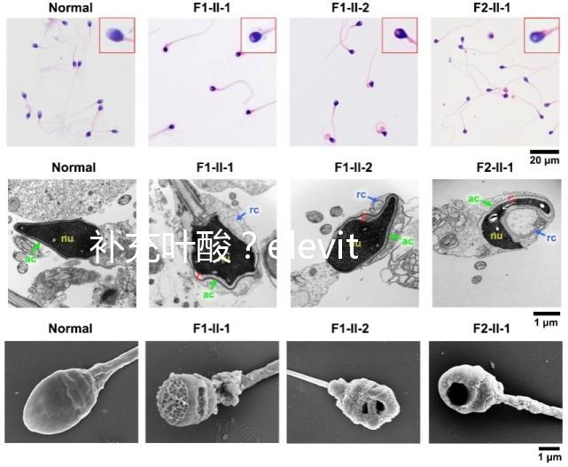 補充葉酸？elevit愛樂維那你不得不了解