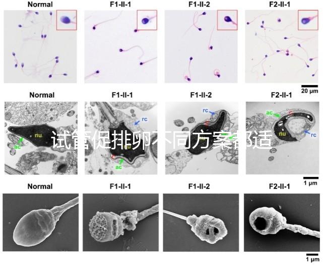 試管促排卵不同方案都適合哪些人？如何監測排卵？