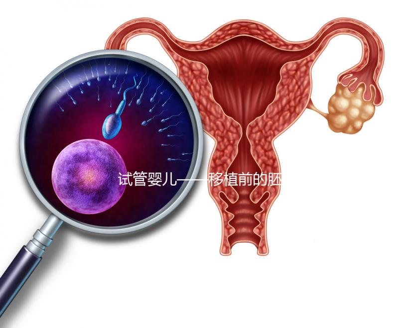 試管嬰兒——移植前的胚胎選擇！