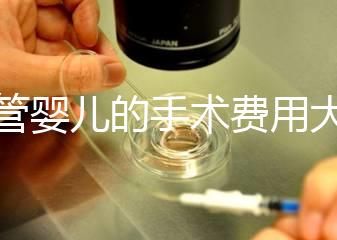 試管嬰兒的手術費用大概是多少
