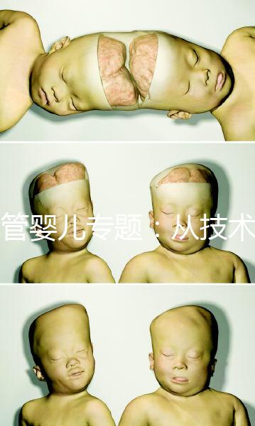 試管嬰兒專題:從技術(shù)原理解讀到成功案例分享