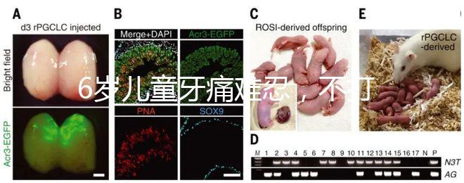6歲兒童牙痛難忍，不打針吃藥5個小妙招快速止疼