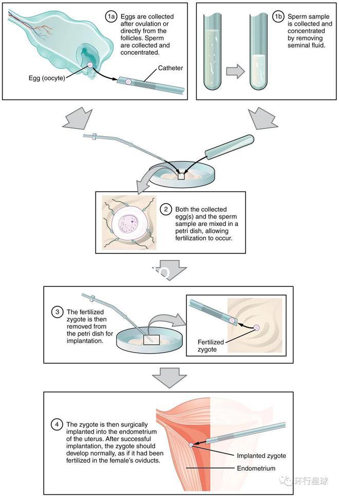 Reprod. Biomed：奇跡、突破、爭議、反思——“試管嬰兒”40年