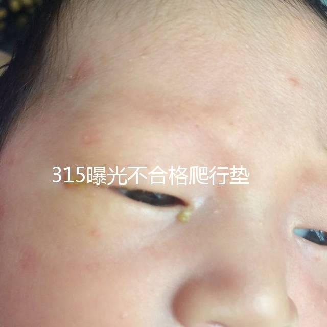 315曝光不合格爬行墊品牌，甲酰胺超標的危害可不小