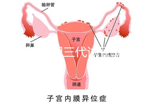 2025昆明三代試管助孕機構收費明細，價格8萬至15萬不等
