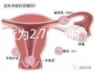 nt檢查為2.7mm時危險性莫亂猜，做完無創(chuàng)后才能確定